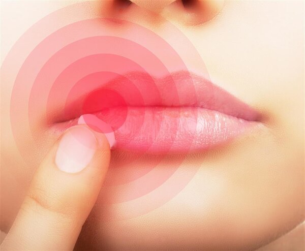 夏季手上脱皮长水泡当心汗疱疹