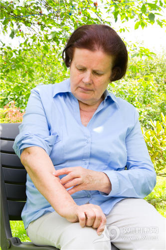 中老年 女 皮肤 过敏 皮疹_30643954_xxl