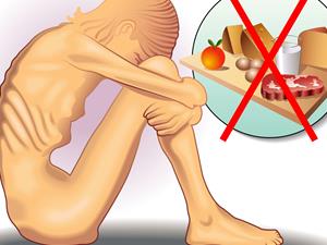 节食减肥的危害 容易低血压！