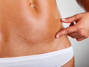 肥肉走开 大肚子杀手竟然是平板支撑