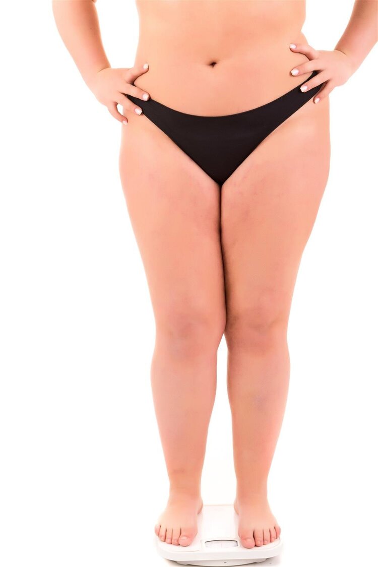 女生大腿外侧肉比较多，该怎么减这个部位