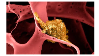 一项癌症疫苗研究：实验小鼠100%存活！人类什么时候能用上？