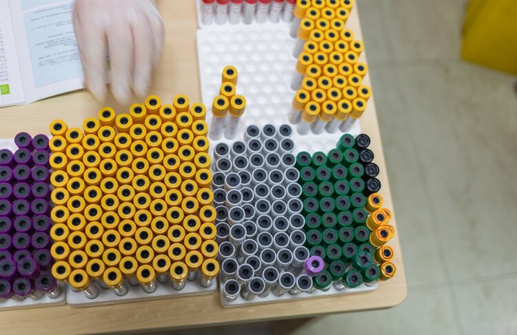 采样前30分钟不喝水、不吸烟、不嚼口香糖