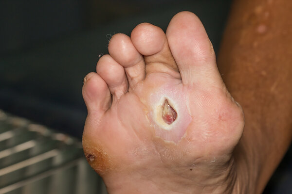 农夫山泉回应瓶装水现大量蛆虫，你知道吗？蛆虫可用来治疗疾病