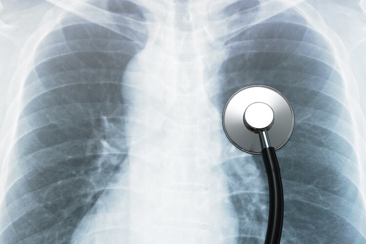 查出癌症应该怎么办？医生提醒：了解3件事情，积极应对