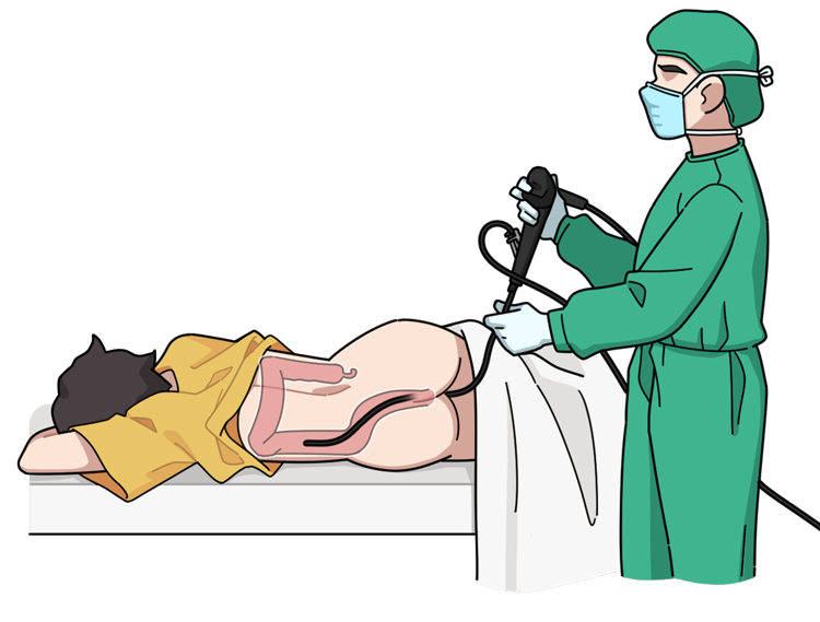 若排便时有3个表现，可能是“肠息肉”在作祟，不要后知后觉