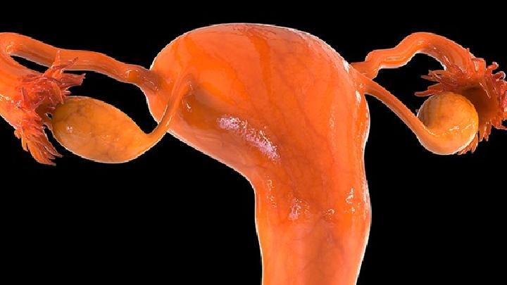 如何自检出是否患有子宫肌瘤的症状