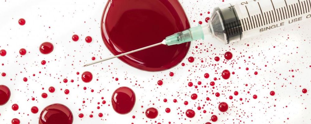 女性治疗尖锐湿疣有哪些误区