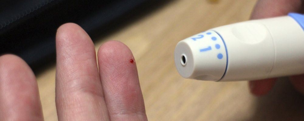 尖锐湿疣会下身瘙痒吗