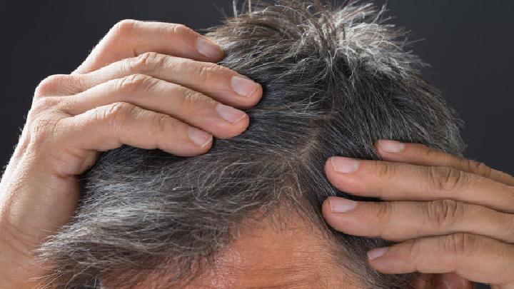 脱发的原因您知道有哪些吗