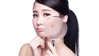 下巴长痘痘怎么办？下巴长痘痘饮食要注意什么？