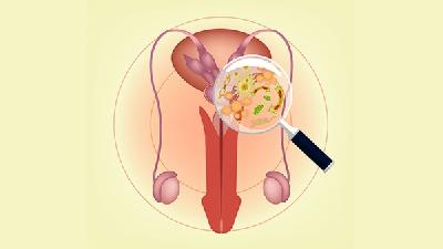 女性子宫肌瘤有哪些危害呢？