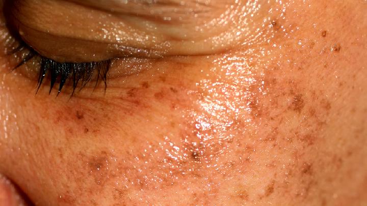 芦荟叶、黄瓜加珍珠粉纯天然美白祛斑