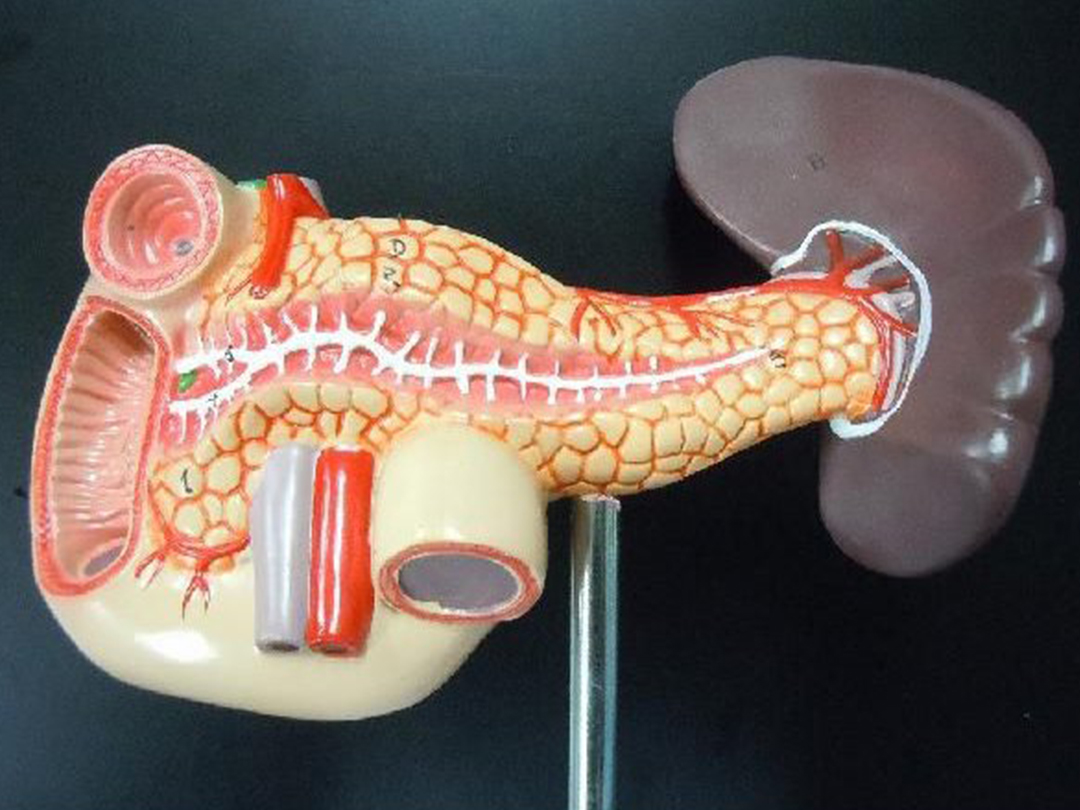 十二指肠壅积症